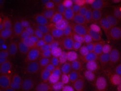 ER alpha/NR3A1, p Ser106 Antibody, Novus Biologicals 0.025 mL; Unconjugated:Antibodies,